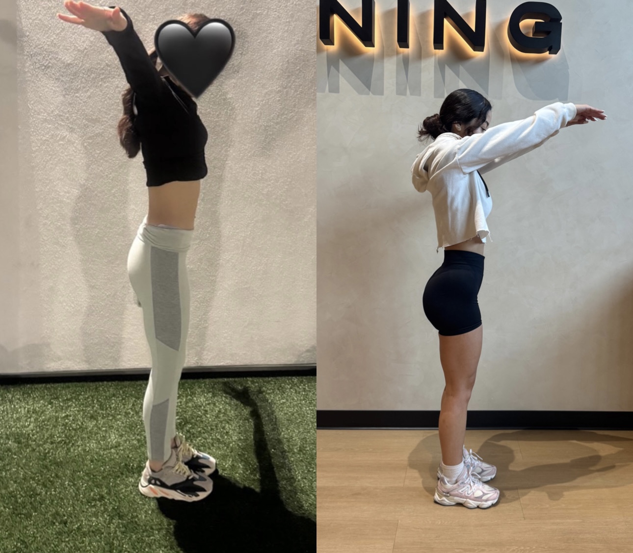 Client side profile glute and leg before and after transformation